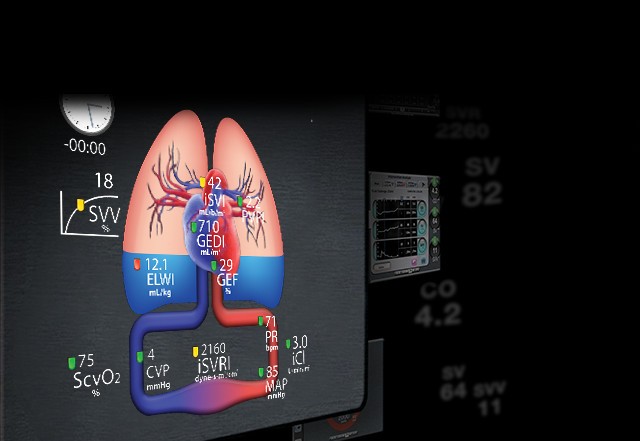 Sistema VolumeView: Evolucionando su manera de ver la termodilucin